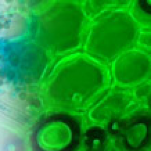 Labomed upright microscopes