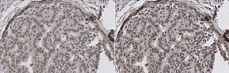 Compare tissue low