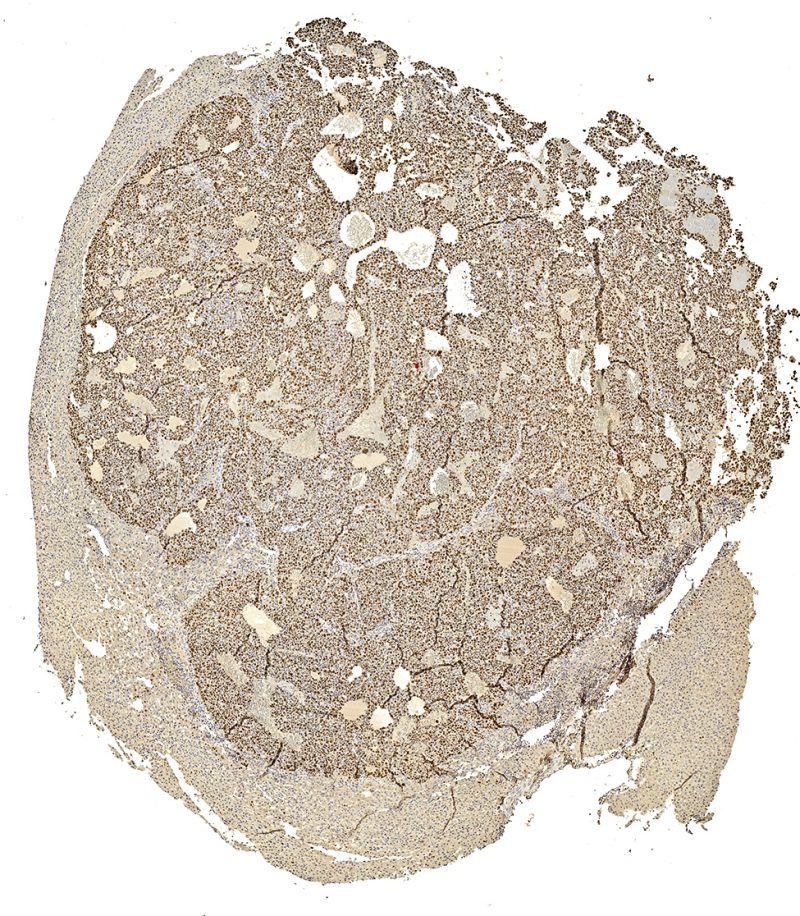 IHC 05 IHC 05