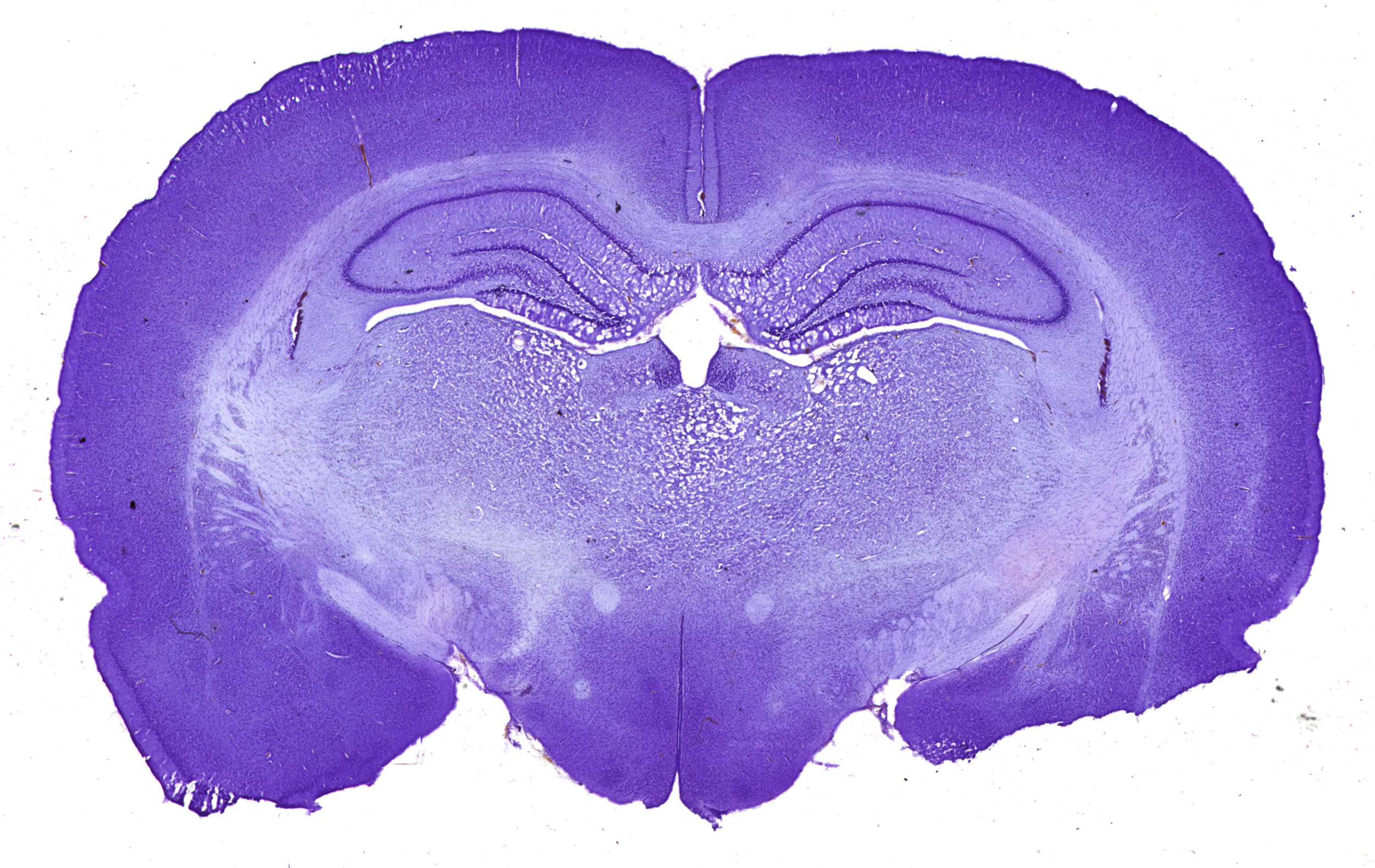 Mouse Brain Section