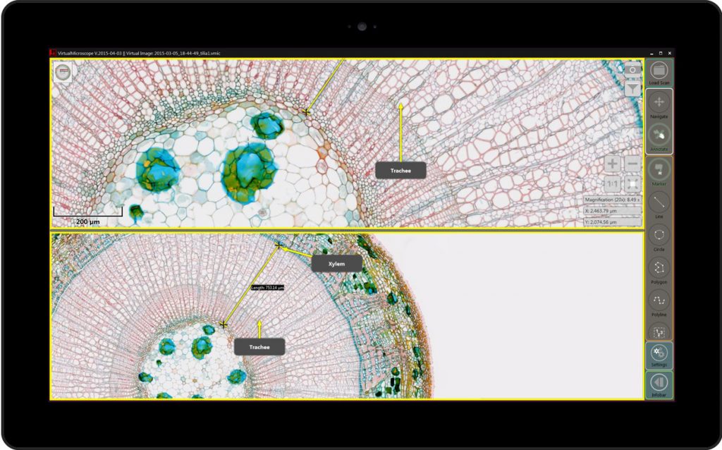 PreciPoint M8 Microscope and Scanner - comparison digitized image