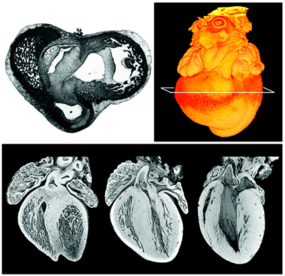 3D image generation with the optical . . . HREM - High Resolution Episcopic Microscope