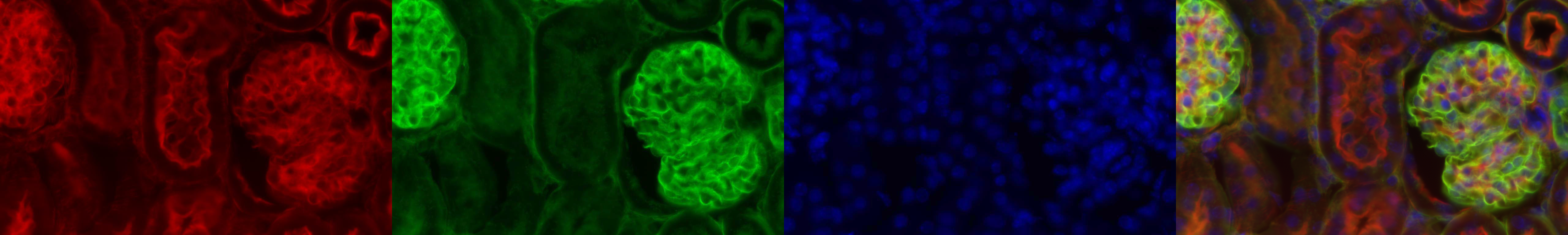 3 color fluorescence
