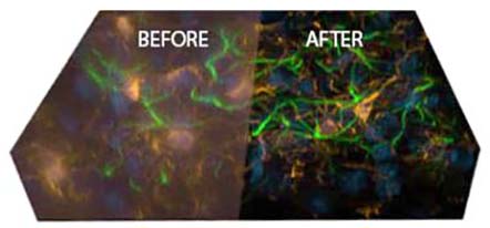 Autoquant deconvolution image