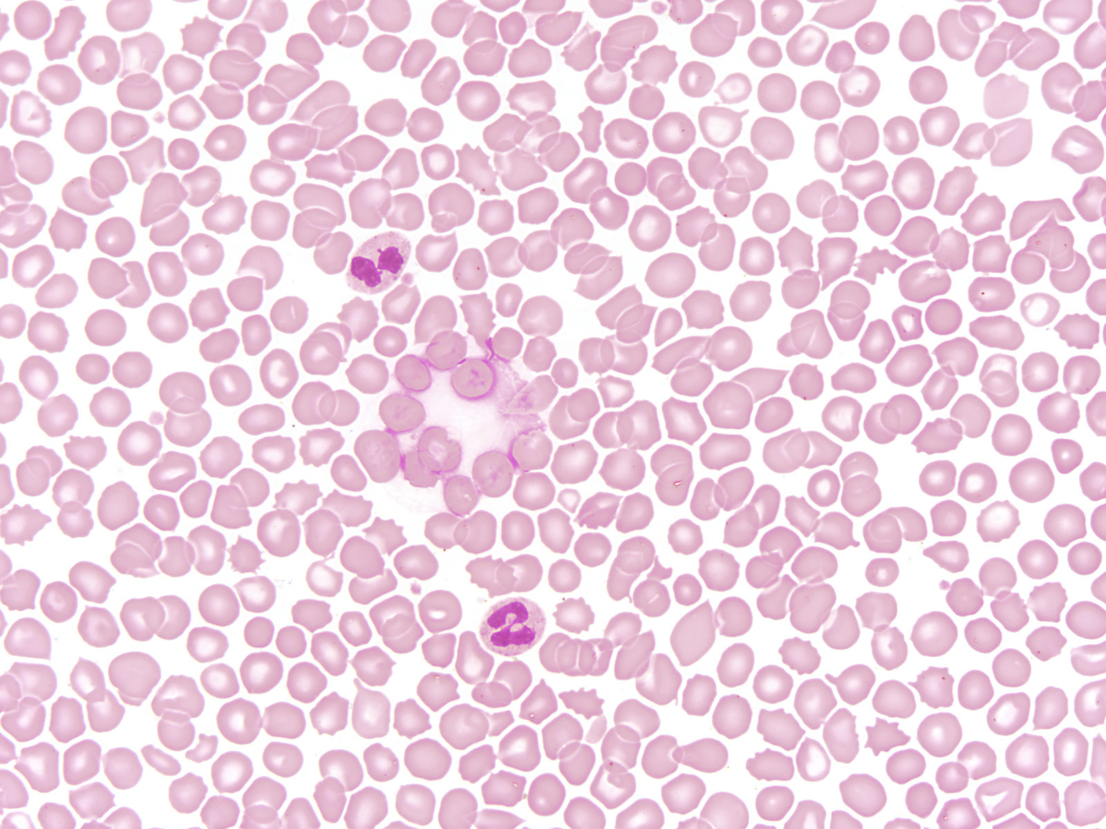 blood-100x-02