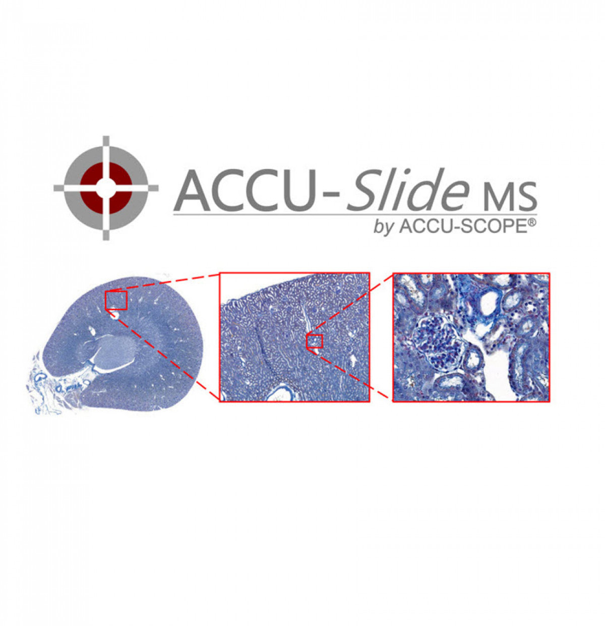 accu-slidems accu-slidems