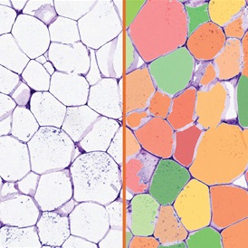 adipocytes-s