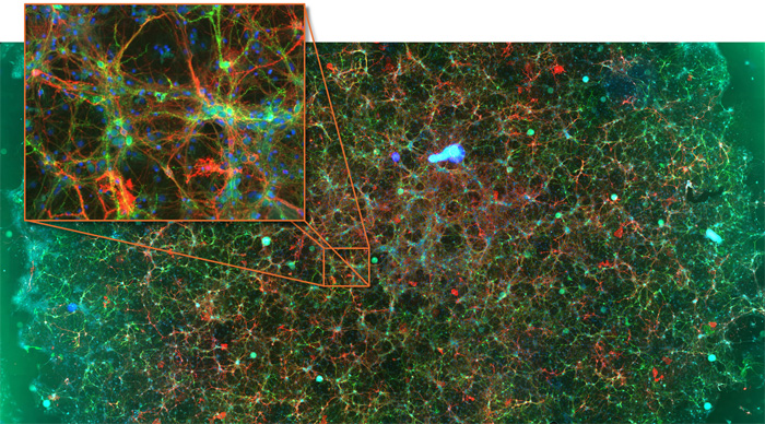 conf-neuronal-cell-culture