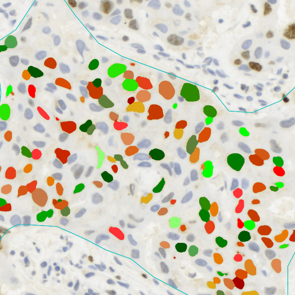 histoquest-thumbnail - Meyer Instruments