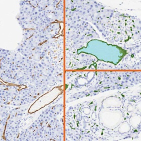 ihc-angio-s