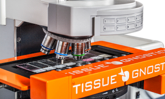 tissuefaxs_upright_331x200