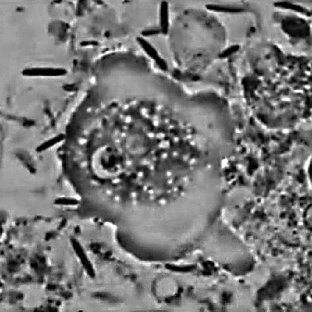 ameoba3-bw_bgcorrected