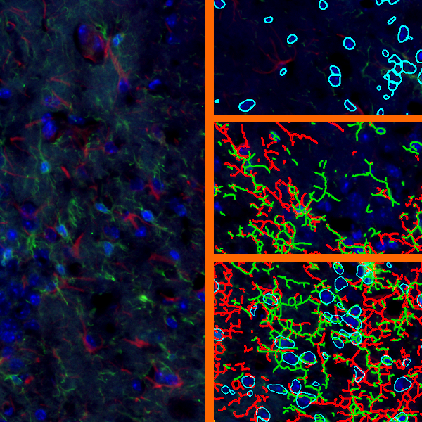 glialcells_imageforwebsite