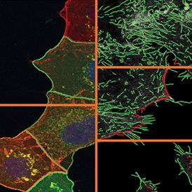 if-cytoskeleton-s
