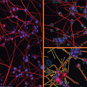 if-neurites-s