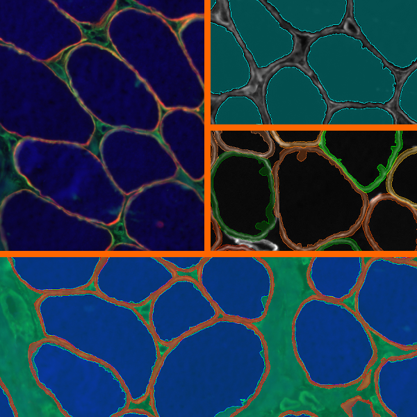 if-skeletal-muscle