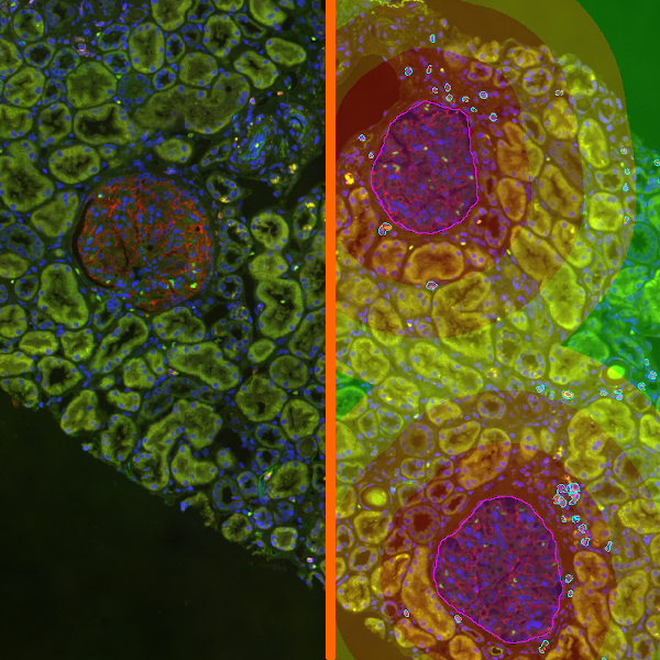 if_glomeruli_app