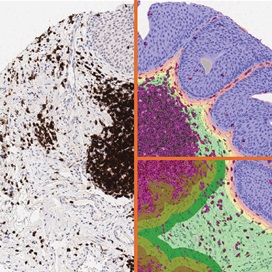 ihc-immune-status-in-situ-s