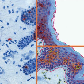 ihc-macrophages-s