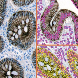 ihc-membrane-s