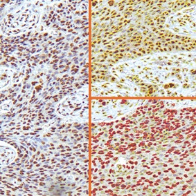 ihc2-s