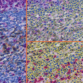ihc3-s