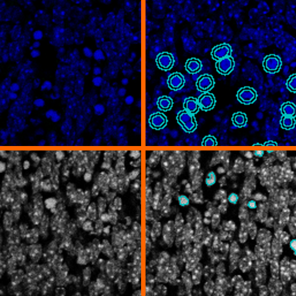 pyknoticnuclei