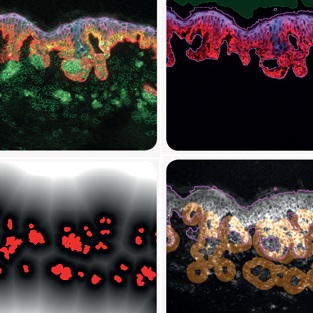 quantifiedantigens