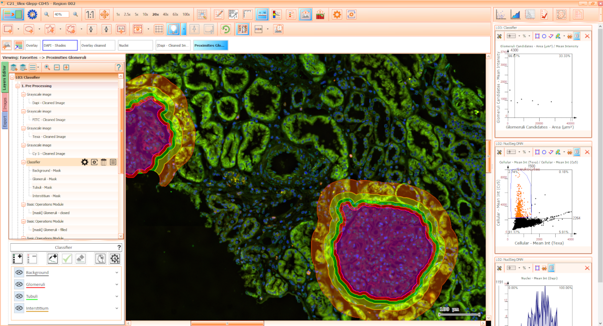 sq_userinferface TissueGnostics StrataQuest Screen Shot
