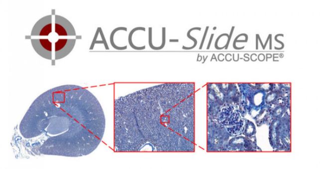 accu-slide-ms