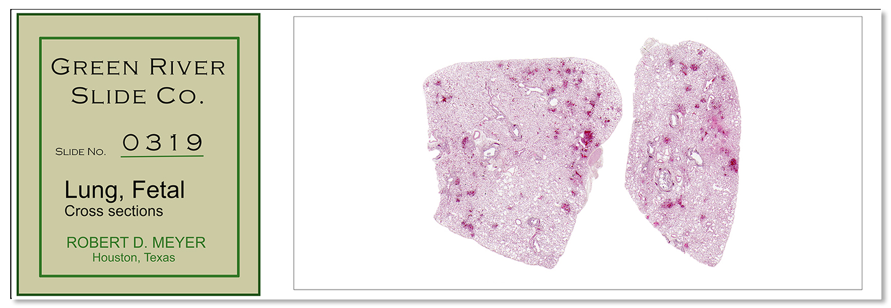319_fetal-lung-ds_sm