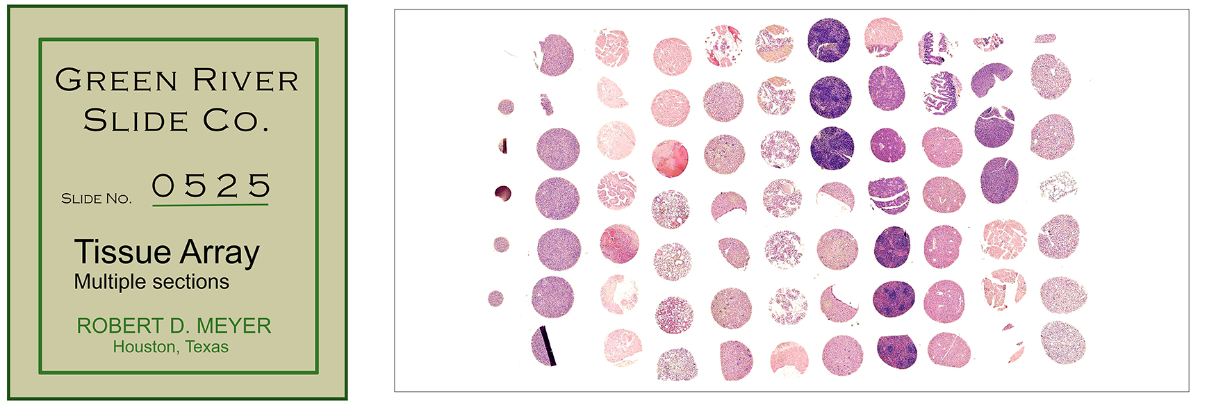 525_tissue-array-ds_sm