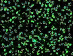 apoptosis-2-pixel-outlines-in-orange Apoptosis