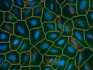 c09a-autophagy-after-1080x806-1 Autophagy