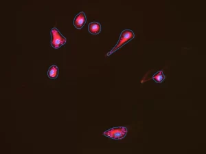c14b-lipid_dropletsafter-1024x801-resized Lipid Droplet