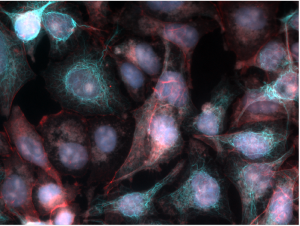 Real Time Deconvolution