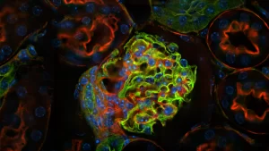 f01b-kidney-after-crop Image-Pro from Meyer Instruments, Inc.