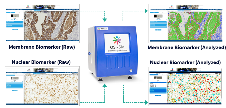 OptraSCAN OS-SiA Artificial Intelligence Digital Pathology Scanner