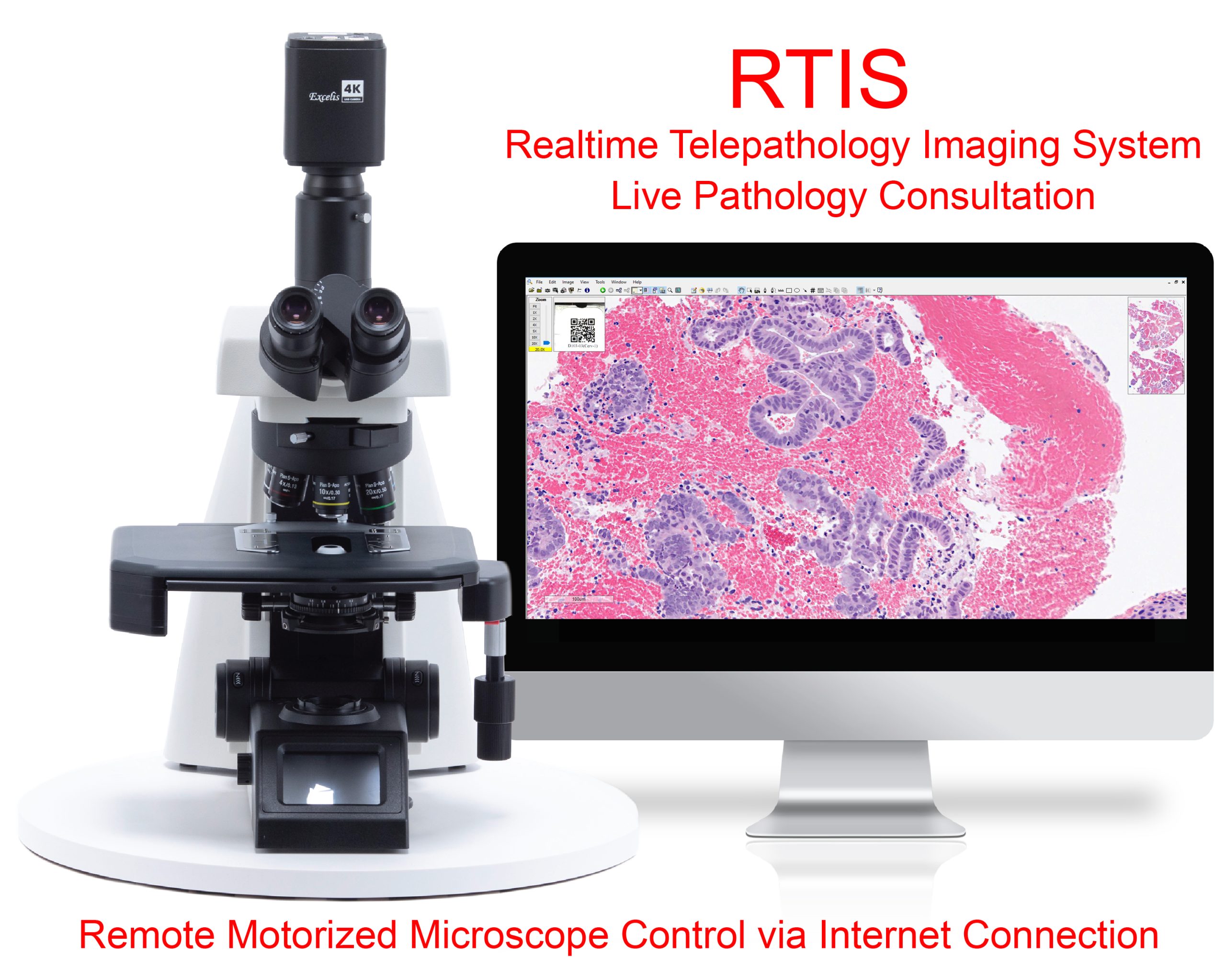 RTIS Real Time Telepathology Imaging System - ROSE