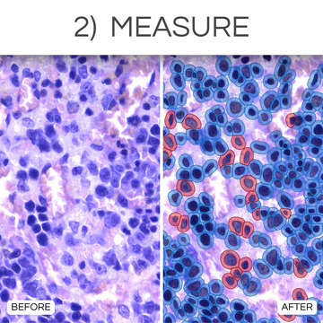 clinical_-_2._measure_360x
