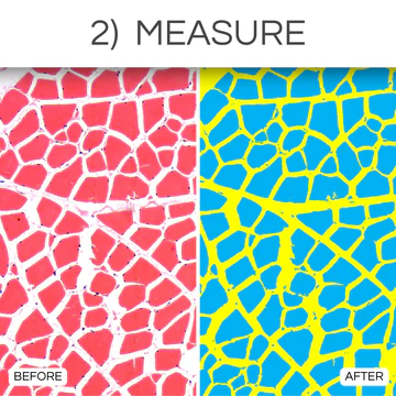 general_bio_-_2._measure_360x