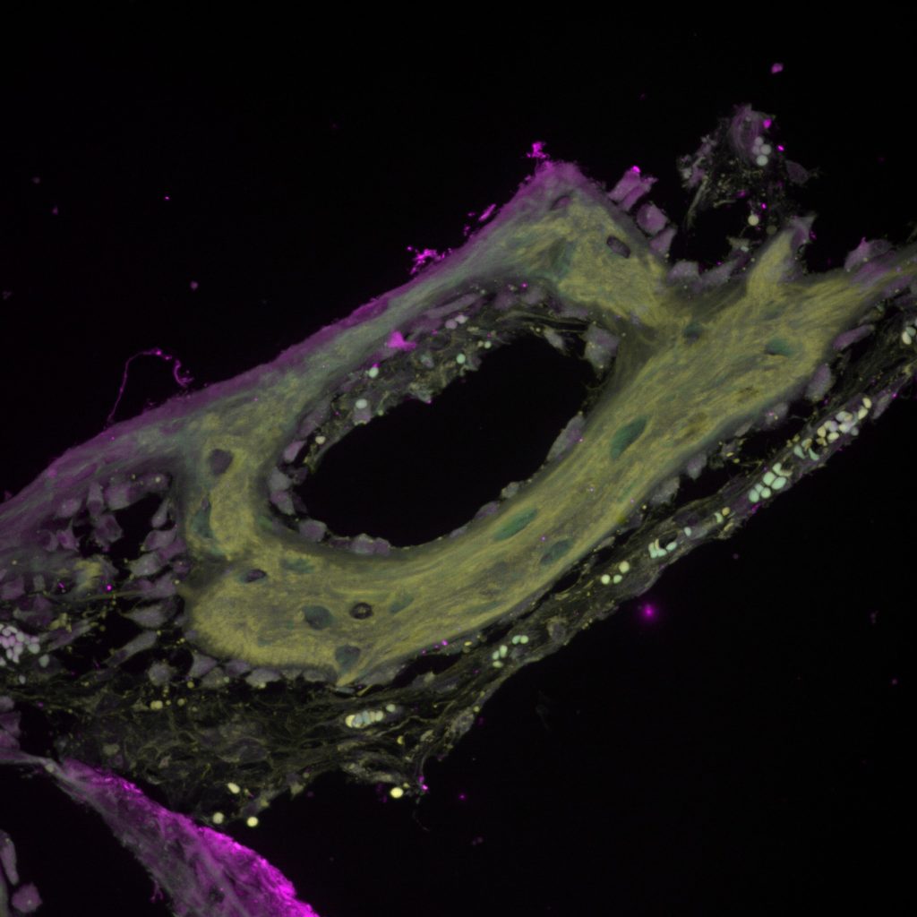 bone_2025-03-07_110935