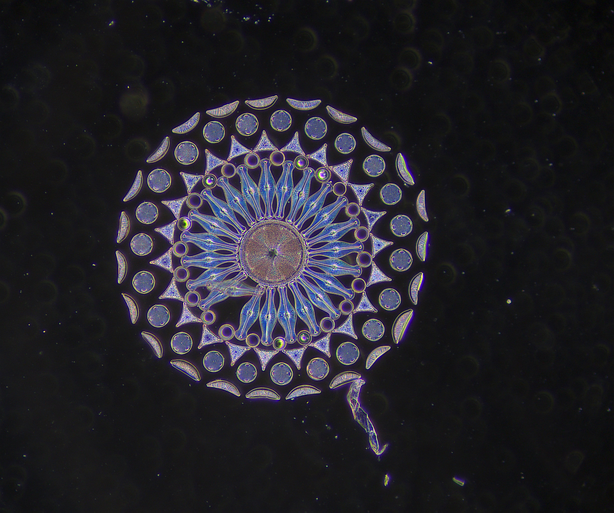 exc-250-darkfield-min Darkfield Image - The NEW ACCU-SCOPE® EXC-250 Microscope Series