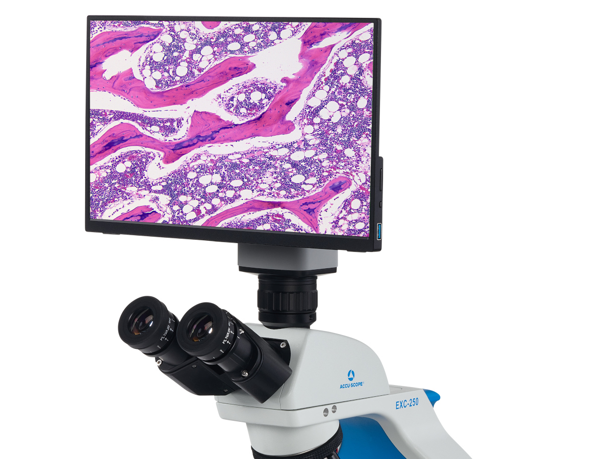 exc-250-hds-with-specimen The NEW ACCU-SCOPE® EXC-250 Microscope Series