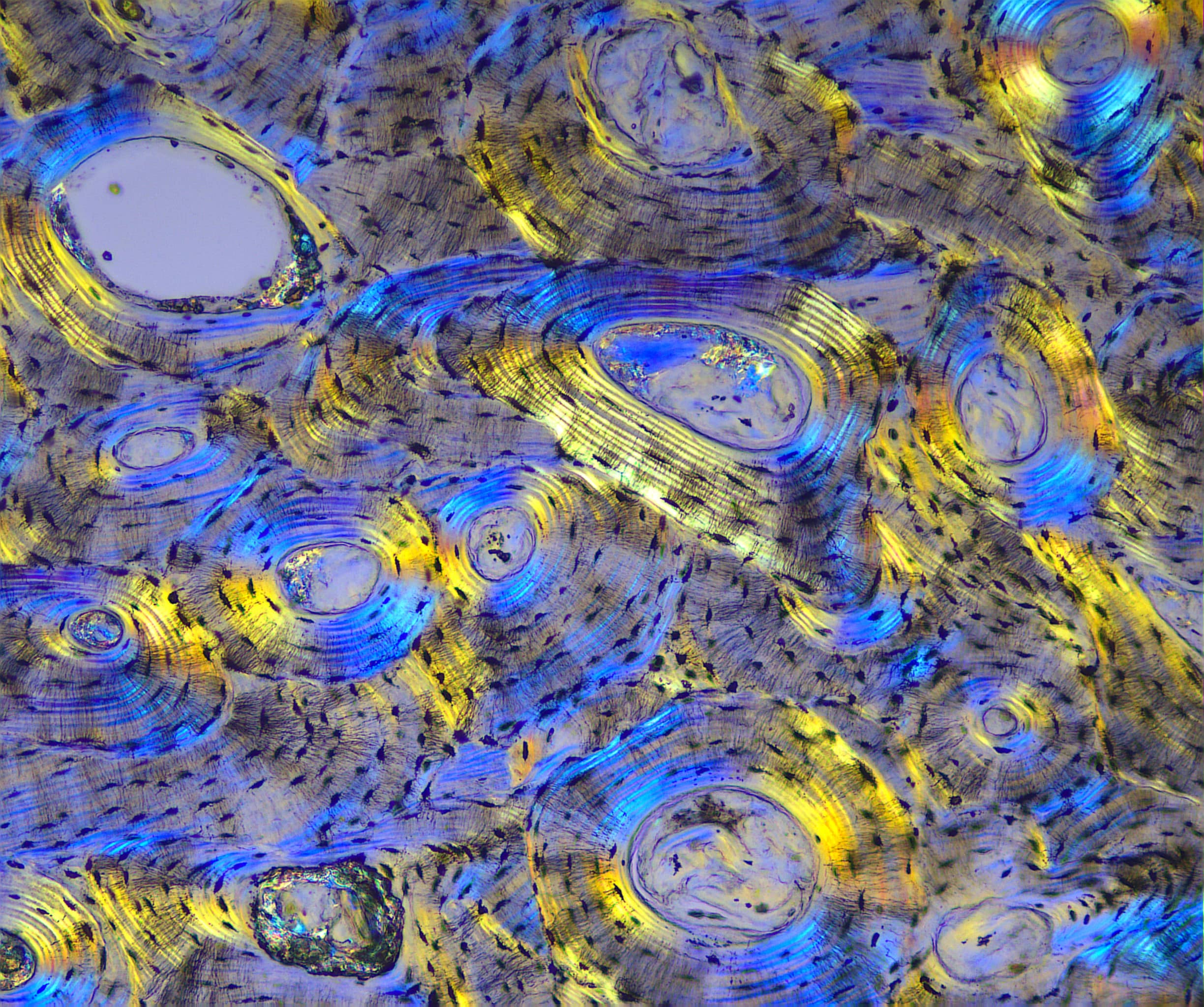exc-250-pol-min Polarized Light Image by The NEW ACCU-SCOPE® EXC-250 Microscope Series