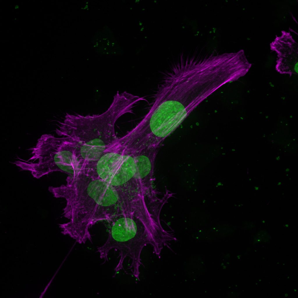 hff_lifeact_mcherry_2025-02-12_155012