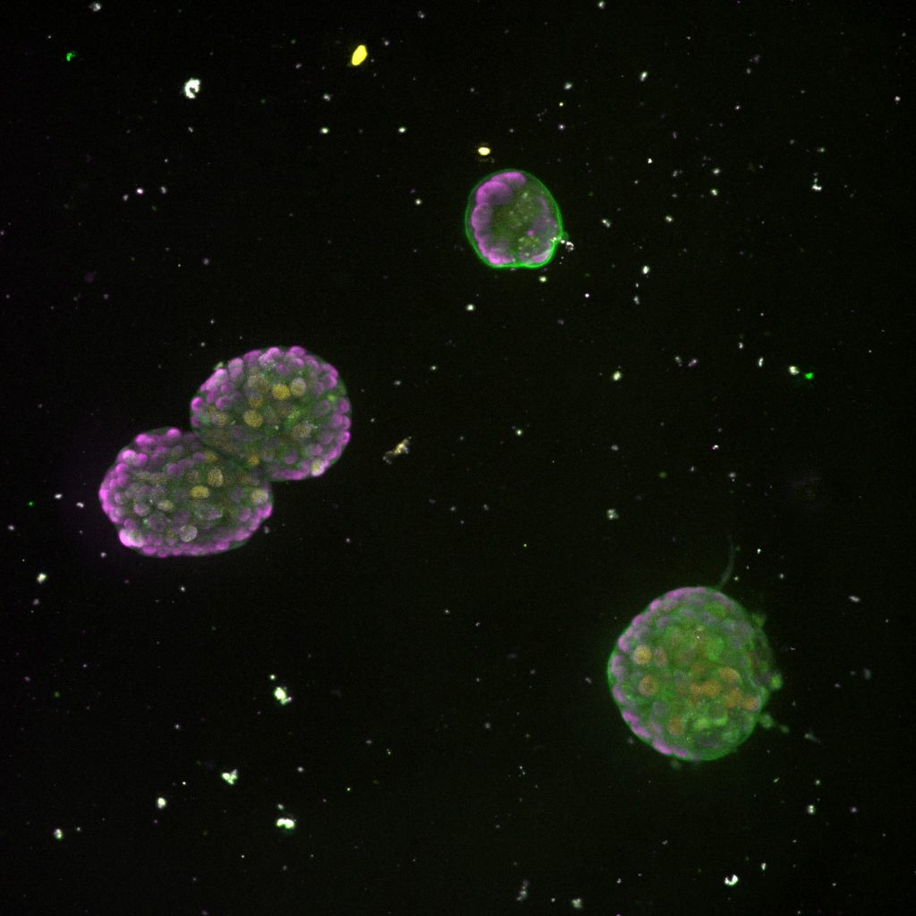 spheroid_2025-03-11_145455