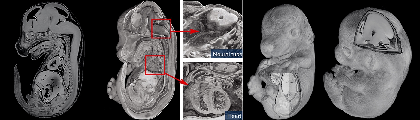 3D image generation with the optical . . . HREM - High Resolution Episcopic Microscope