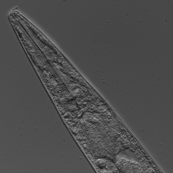 c.-elegans-20x-dic-edf